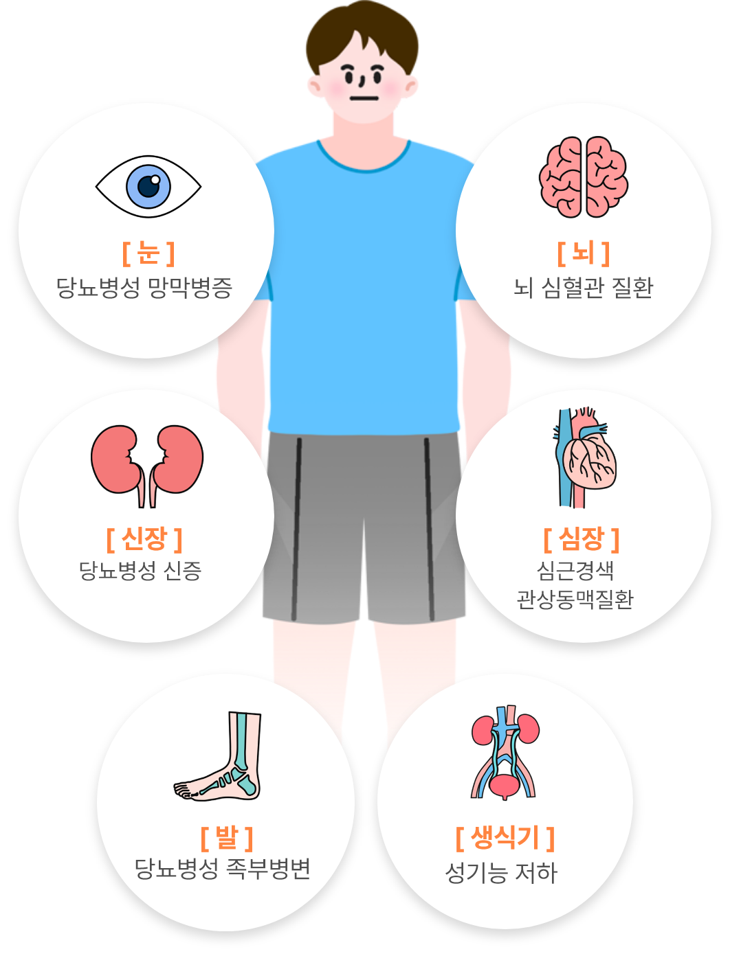 눈:당뇨성 망막병증, 뇌:심혈관질환, 심장:심근경색 관상동맥질환, 콩팥:당뇨병성 신증, 성기능저하, 발 : 당뇨병성 측부병변;